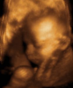 Ultrasound of a 6 month pregancy for a Christian couple